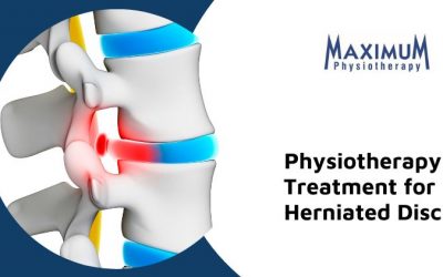 What To Expect With Physiotherapy If You Experience A Herniated Disc
