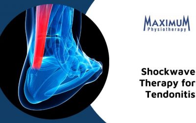 Shock Wave Therapy for Tendonitis: Healthy, Safe, and Successful Pain Relief