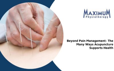 Beyond Pain Management: The Many Ways Acupuncture Supports Health
