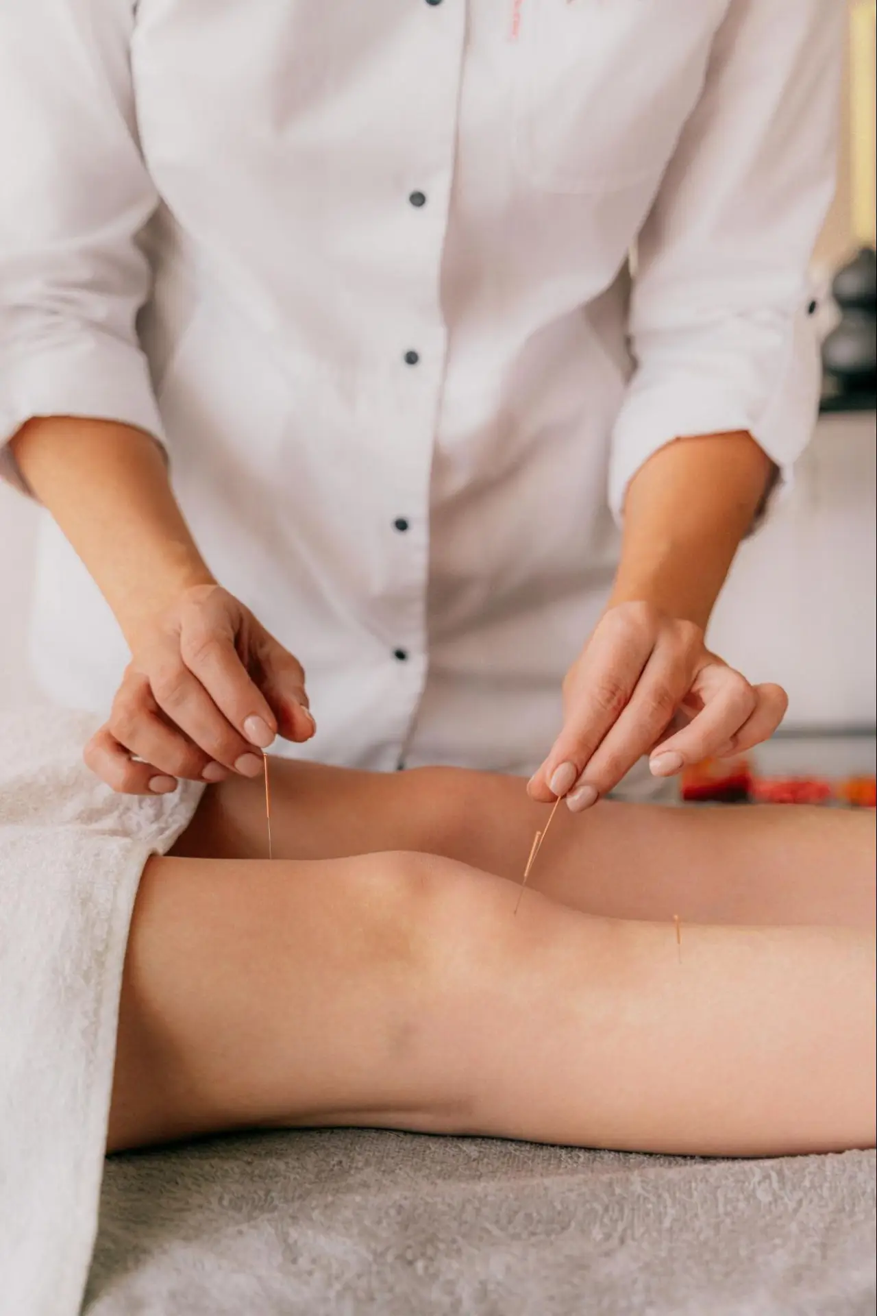 best acupuncture in collingwood