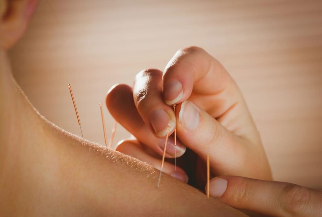 enhancing acupuncture with patient education