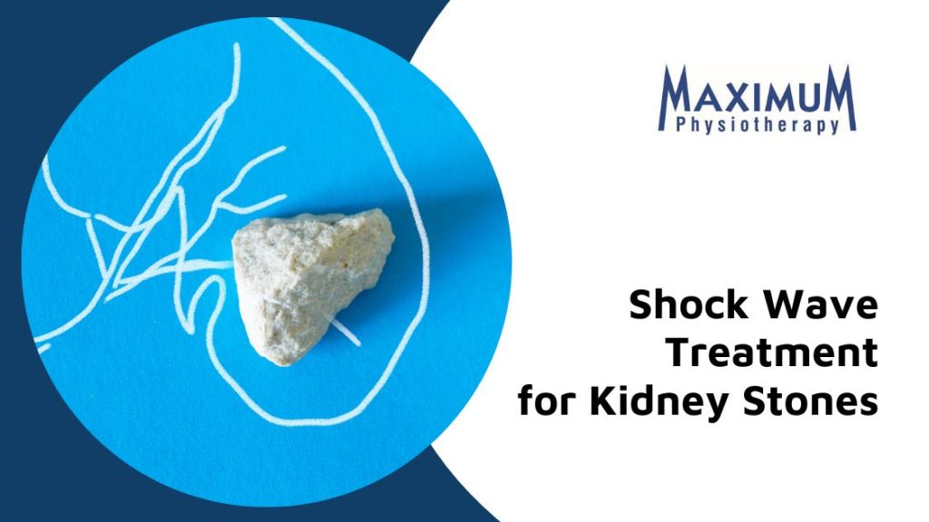 Shockwave Therapy is The Best Solution for Kidney Stones